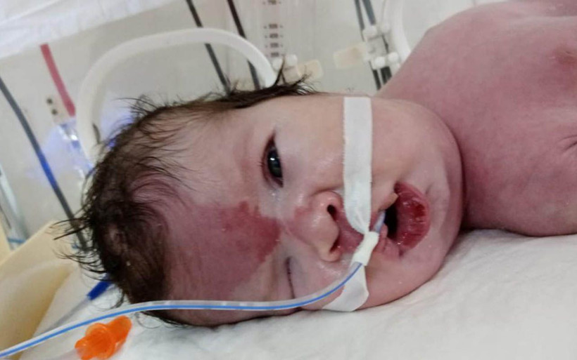 Gaziantep'te doğum raporunda erkek denen bebekleri kız çıktı - Resim: 4