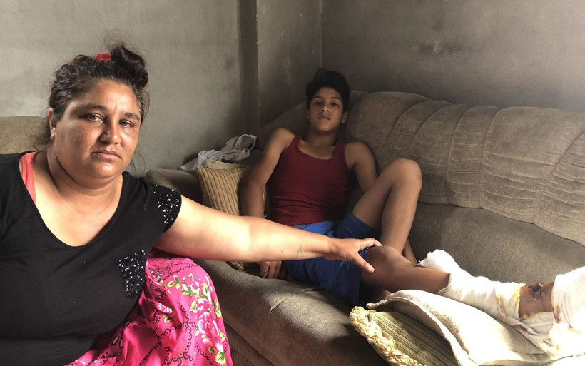 Adana'da pitbull 13 yaşındaki çocuğu bu hale getirdi! Beni köpek yiyor kurtarın.. - Resim: 2