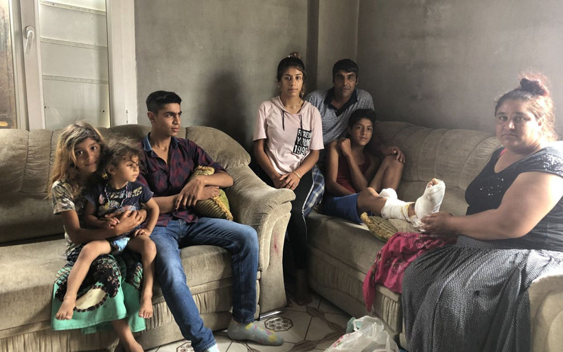 Adana'da pitbull 13 yaşındaki çocuğu bu hale getirdi! Beni köpek yiyor kurtarın.. - Resim: 3