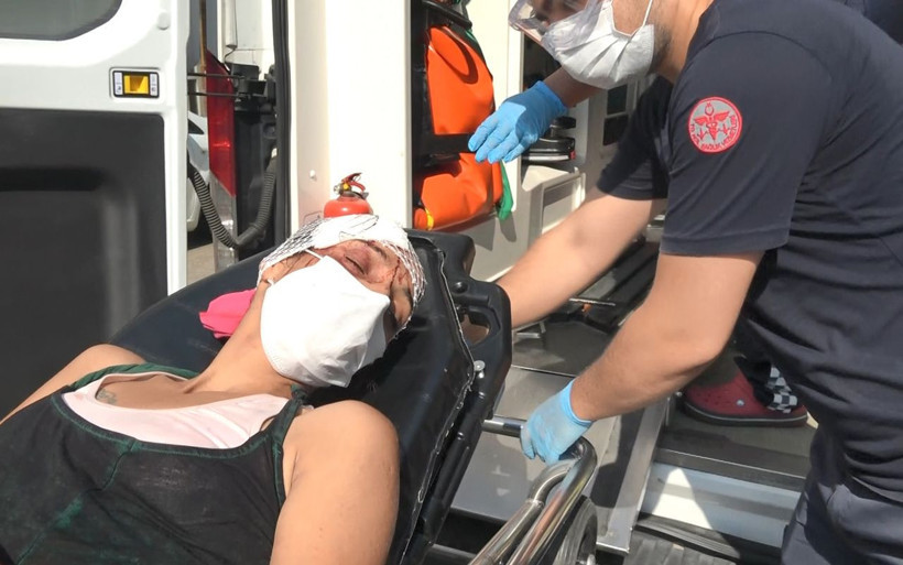 Bursa'da sevgili dehşeti! Başından yaralandı canını zor kurtardı - Resim: 2