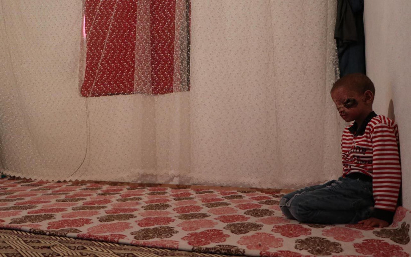 Erzurum'da cilt kanseri 8 yaşındaki Salih yardım bekliyor - Resim: 3