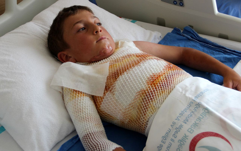 Ardahan'da gömleğimdeki ipi yakayım derken kendini yaktı - Resim: 2