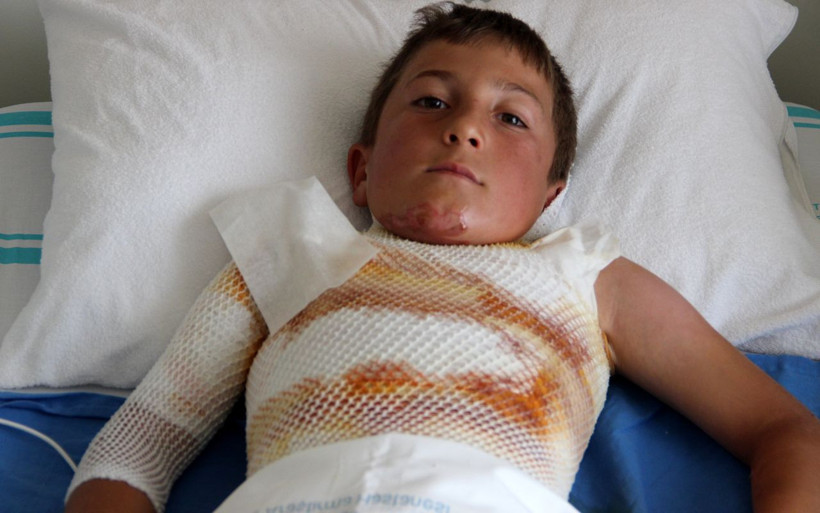 Ardahan'da gömleğimdeki ipi yakayım derken kendini yaktı - Resim: 1