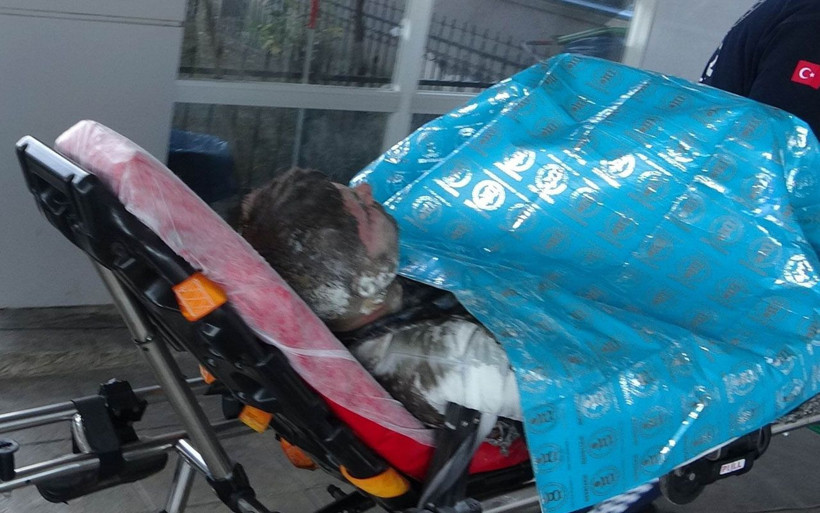 Samsun'da benzin döküp kendini yaktı! 'Ben büyük bir şerefsizlik yaptım' dedi - Resim: 3