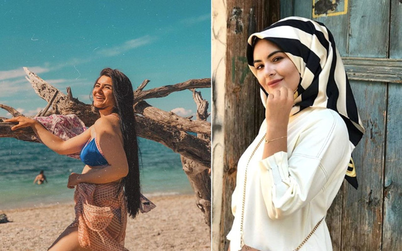 Gelin adayı Hanife Gürdal dudak botoksunu abarttı bakın ne hale geldi - Resim: 2