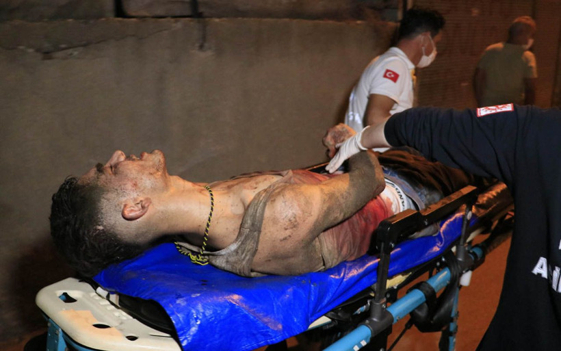 Adana'da kanlar içinde sokak ortasında bulundu - Resim: 1