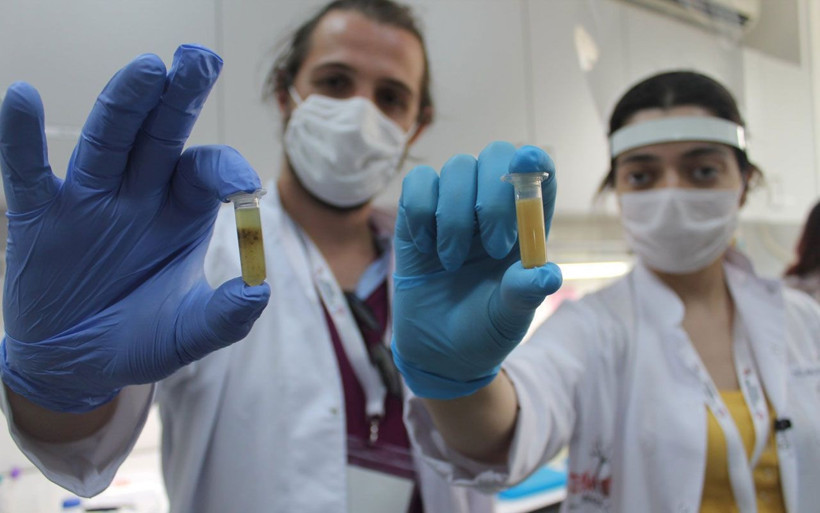 Biyoteknolojinin Renkleri projesinde önemli tespitler! GDO, klonlama, biyoterörizm, adli genetik - Resim: 4