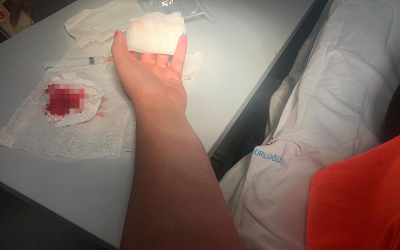 Sinop'ta akılalmaz olay genç kızın yemeğe gittiği köftecide parmağı koptu - Resim: 1