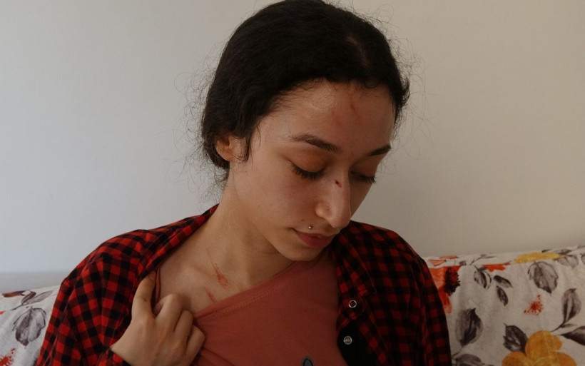 Balayından beri dövüyordu Mersin'de dayakçı koca dehşeti! - Resim: 2