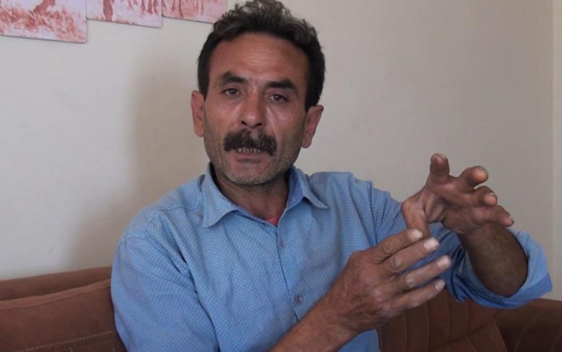 Aydın'da yaşadığı travmayı unutamıyor beslediği pitbull'un saldırdığı adam: Silahtan farkı yok - Resim: 4