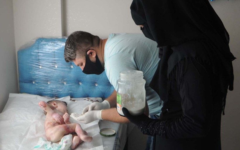 Görenin yüreği burkuluyor Şanlıurfa'da kelebek hastası Abdullatif için ailesi yardım istiyor - Resim: 4