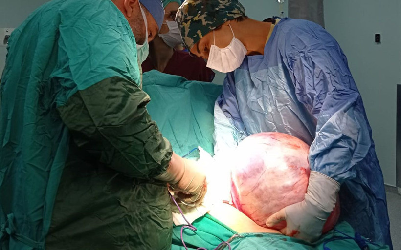 5 buçuk kilo ağırlığındaki tümör Niğde'de kadının karnından çıktı - Resim: 4
