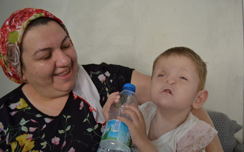 Burun delikleri yok sırtında tümör var Manisa'da Sevgi Hira annesini temasla tanıyor - Resim: 3