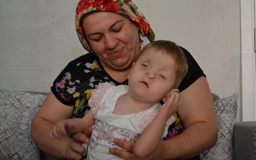 Burun delikleri yok sırtında tümör var Manisa'da Sevgi Hira annesini temasla tanıyor - Resim: 1