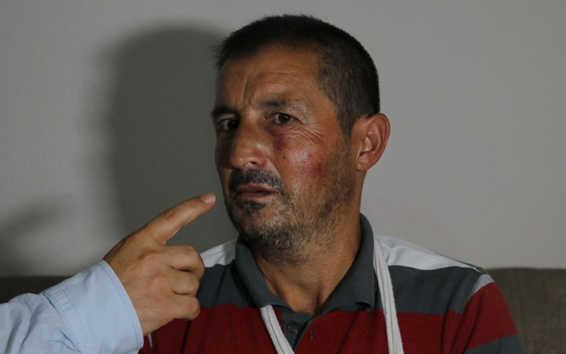 Adana'da işitme engelli adama korkunç saldırı! Burnu kırıldı ve kolu çatladı - Resim: 2