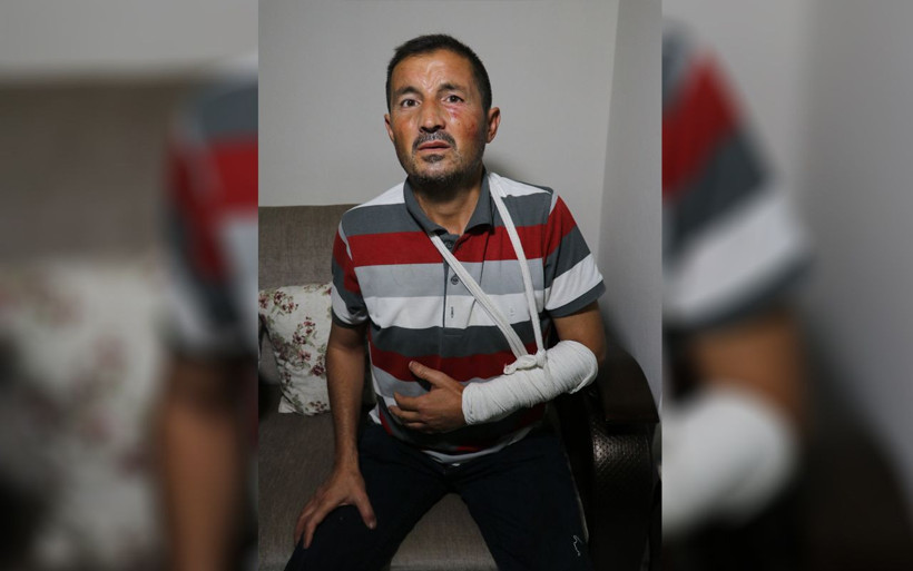 Adana'da işitme engelli adama korkunç saldırı! Burnu kırıldı ve kolu çatladı - Resim: 4