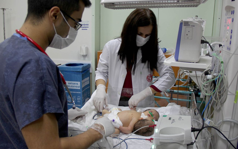 Siyam ikizleri Hatay'da tedavi altına alındı tek kalple yaşama tutunuyorlar! - Resim: 4
