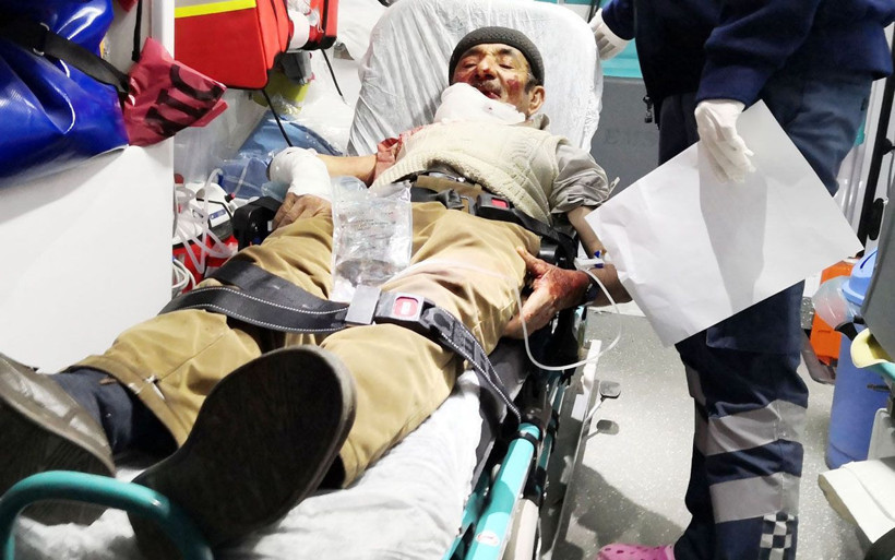 Aksaray'da misafirliğe giden adama köpek saldırdı! Vücudunu parçaladı - Resim: 3