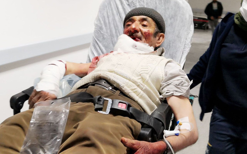 Aksaray'da misafirliğe giden adama köpek saldırdı! Vücudunu parçaladı - Resim: 1