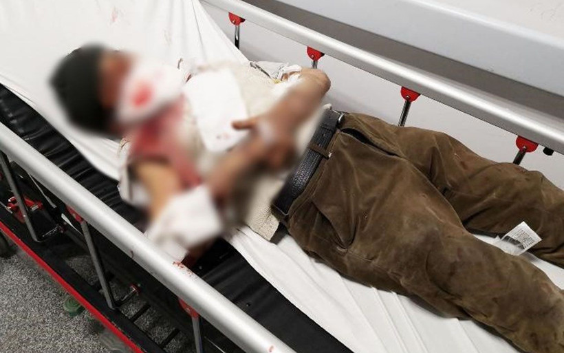 Aksaray'da misafirliğe giden adama köpek saldırdı! Vücudunu parçaladı - Resim: 4