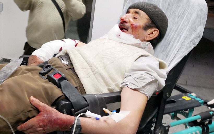 Aksaray'da misafirliğe giden adama köpek saldırdı! Vücudunu parçaladı - Resim: 2