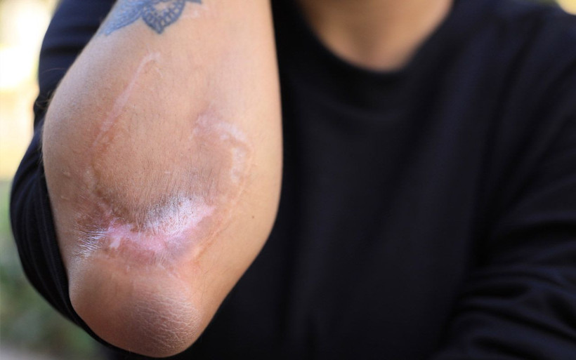 Antalya'da ayrılmak isteyen kadını döner bıçağıyla doğradı kabus geri gelecek! - Resim: 2