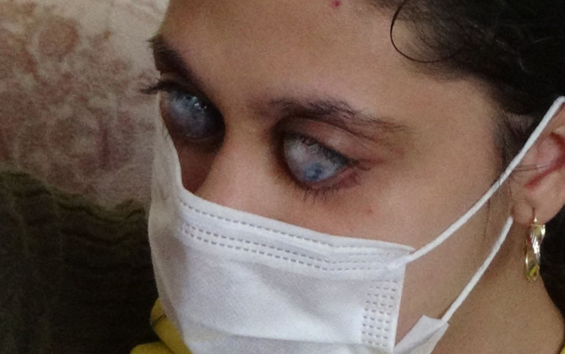 Balıkesir'de genç Ümran'ı görenler gözlerine inanamıyor 'photoshop' diyorlar - Resim: 1