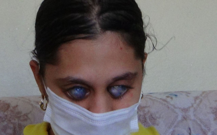 Balıkesir'de genç Ümran'ı görenler gözlerine inanamıyor 'photoshop' diyorlar - Resim: 4