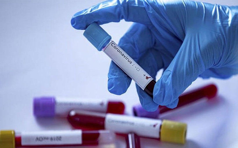 Covid-19'un en erken semptomu keşfedildi: Burunda tuhaf bir his ve aşırı kuruluk - Resim: 3