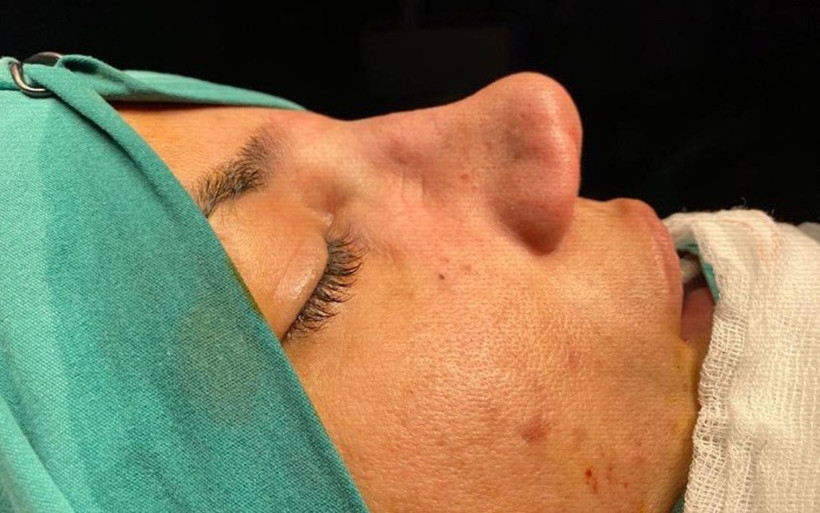 Esenyurt'ta burun estetiği kabusu olan kadının çocuğu: Anne senin burnun yamuk - Resim: 2