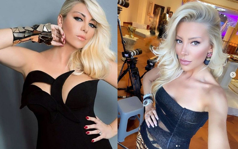 Gülşah Saraçoğlu'ndan olay yaratan estetik itirafı 'Yüz nakli yaptırdım diyebilirim' - Resim: 2