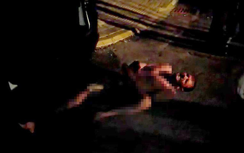 Antalya'da eşini öldüresiye döven adamdan şok savunma: Kendi kendine yapmıştır - Resim: 1