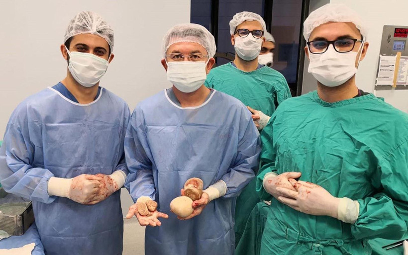 Denizli'de 18 yıllık doktor böylesini hiç görmedi! Mesanesinden çıktı hatıra olarak aldı - Resim: 1