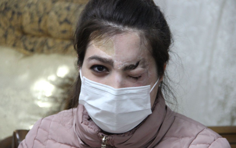 Manisa'da göz kapağı koptu! Genç kızın en büyük hayali aynalarla barışmak - Resim: 4