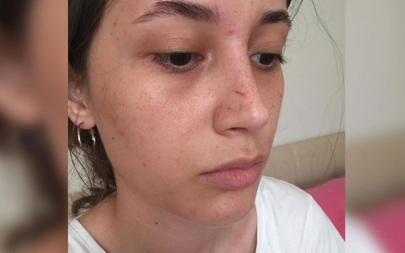 Kafaya bak! Şort giydi diye bastonla 20 yaşındaki kızın burnunu kırdı 'erkek adamım' diye savundu - Resim: 1