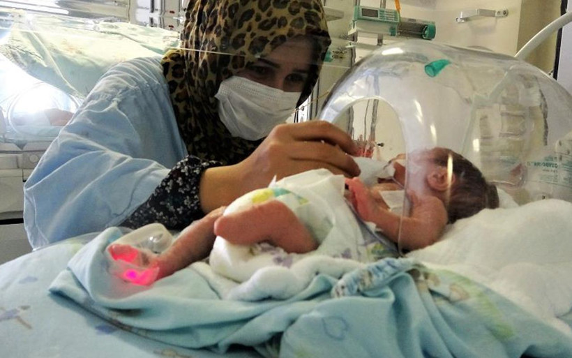 Tokat'ta parmak bebek ayaksız olarak dünyaya geldi hayata tutundu - Resim: 1