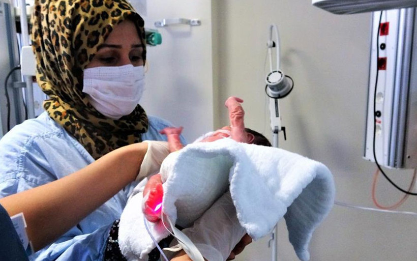 Tokat'ta parmak bebek ayaksız olarak dünyaya geldi hayata tutundu - Resim: 3