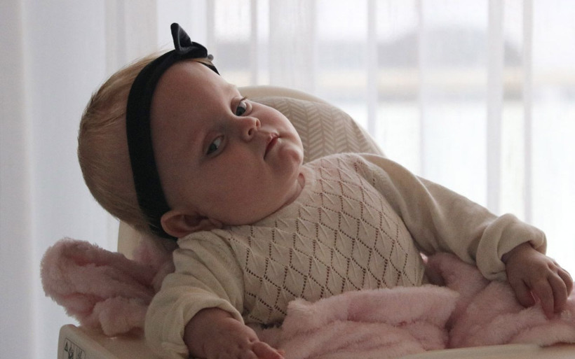 Sağlık Bakanlığı sahip çıkmıştı Alicia bebek 1 yaşına sağlıkla birlikte girdi - Resim: 2