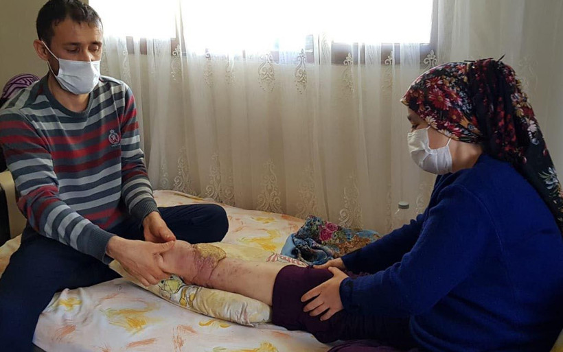 Hatay'da sabahlara kadar çığlık atıyor! Ameliyat olamazsa ayağını kaybedecek - Resim: 2