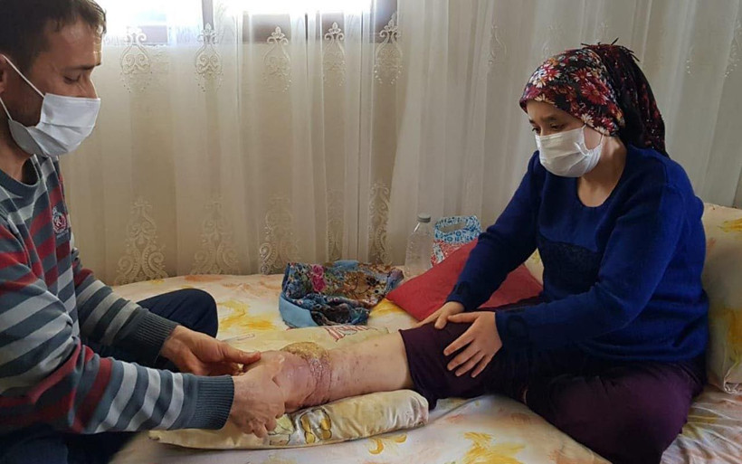 Hatay'da sabahlara kadar çığlık atıyor! Ameliyat olamazsa ayağını kaybedecek - Resim: 4