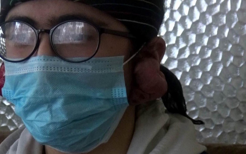 Küpe taktı kulaklarında keloid oluştu! Erzincan'da Yağmur'un kulakları sürekli kanıyor - Resim: 1