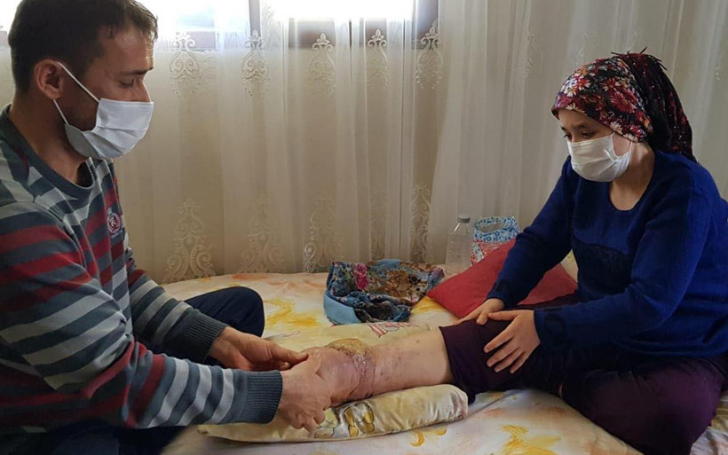 Hatay'da sabahlara kadar çığlık atıyor! Ameliyat olamazsa ayağını kaybedecek - Resim: 1