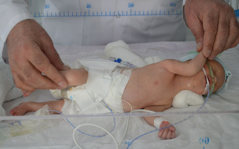 Muş'ta kilosu kadar tümör vücuduna yapışık dünyaya geldi! 1 kilo 600 gram tümör alındı - Resim: 2