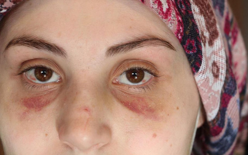 Antalya'da kaçarak evlendi kabusu yaşamaya başladı! Genç kadını banyoya götürüp... - Resim: 1