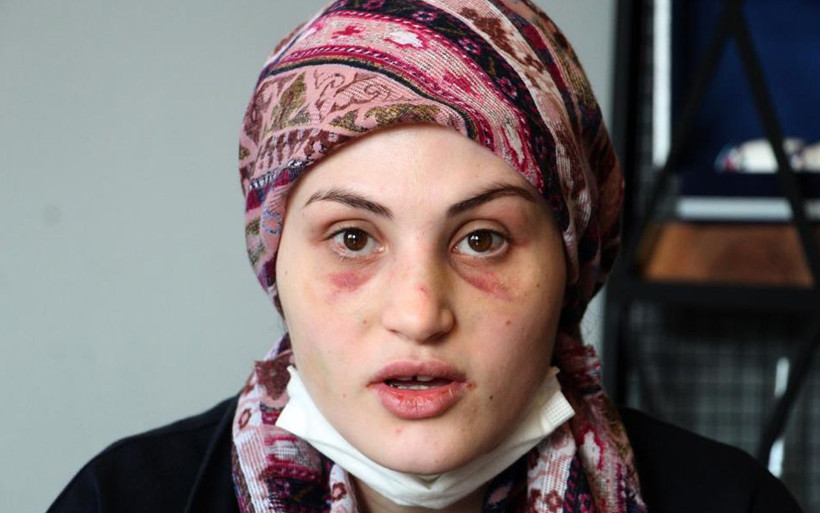 Antalya'da kaçarak evlendi kabusu yaşamaya başladı! Genç kadını banyoya götürüp... - Resim: 2