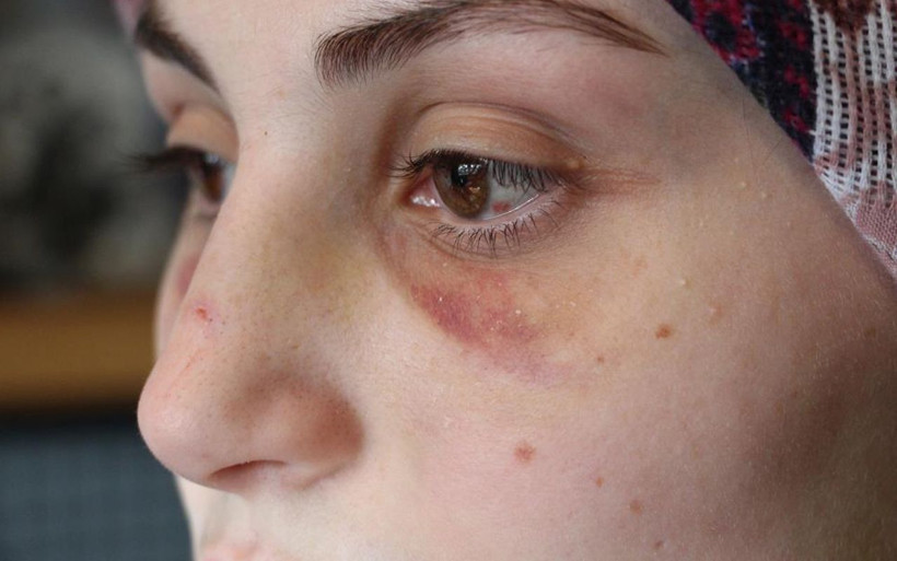 Antalya'da kaçarak evlendi kabusu yaşamaya başladı! Genç kadını banyoya götürüp... - Resim: 3