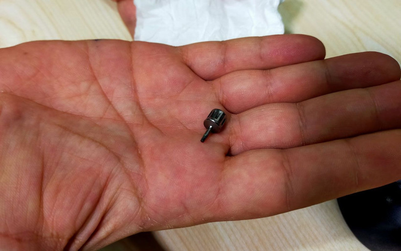 Bursa'da akciğerine kaçtı! Dişçiye implant taktırmak için gitti ucuz kurtuldu - Resim: 2