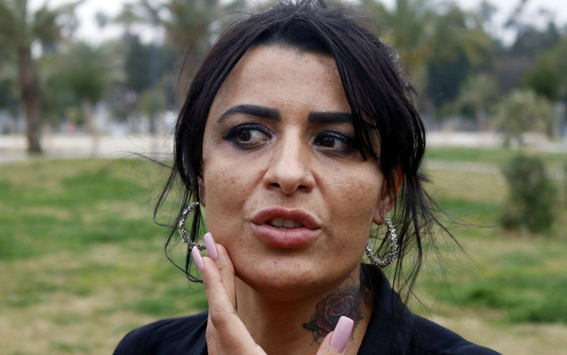 Antalya'da estetik uğruna yüzü yanan kadını bilmeyen kalmadı! Aynalarla barıştı - Resim: 3