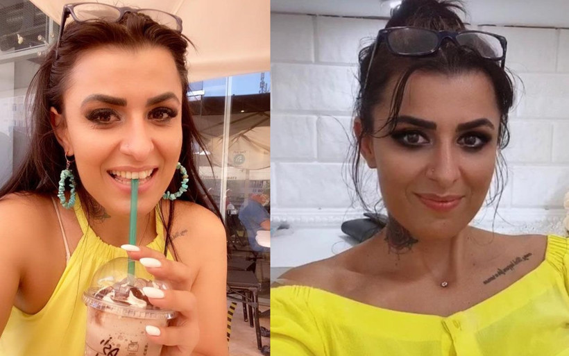 Antalya'da estetik uğruna yüzü yanan kadını bilmeyen kalmadı! Aynalarla barıştı - Resim: 1