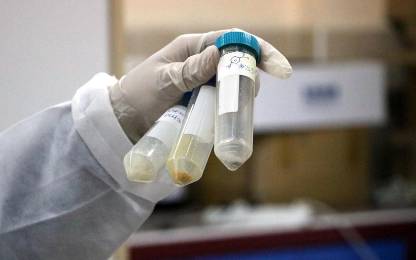 Uğur Şahin ve Özlem Türeci kıskanacak! Etken madde geliştirdi Covid-19 çoğalamıyor - Resim: 3